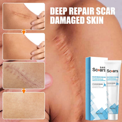 New Herbal Scar Repair Cream