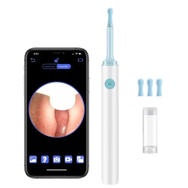 Smart Visual Ear Cleaner